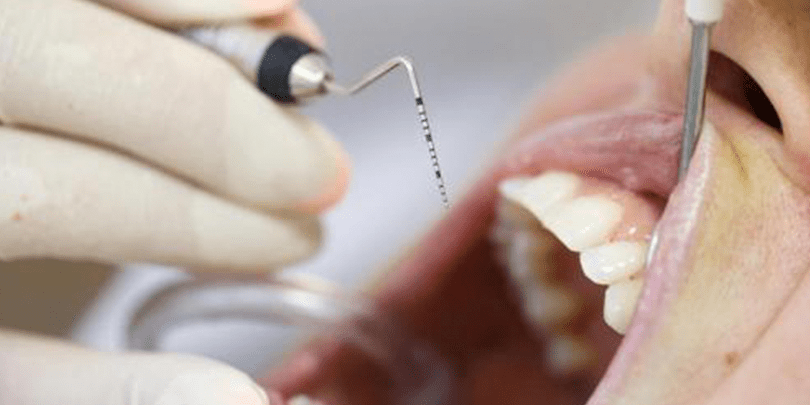 Dental Examination for Periodontal Disease