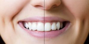 Orthodontics vs Dentist