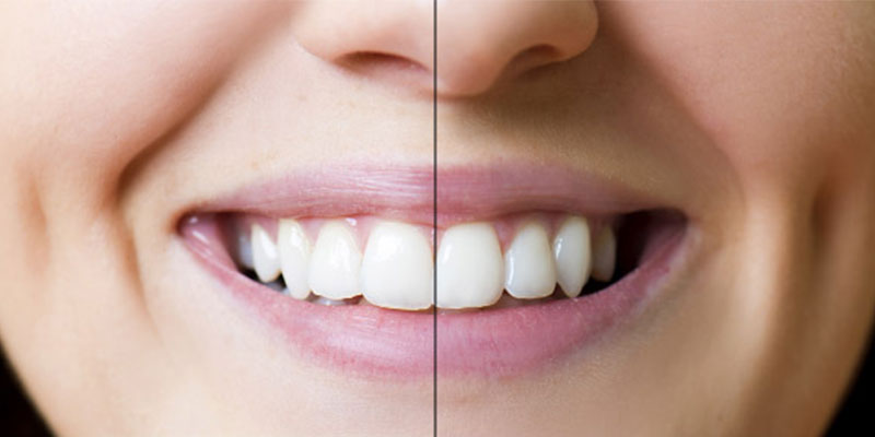 Orthodontics vs Dentist -Your Broadway Dental